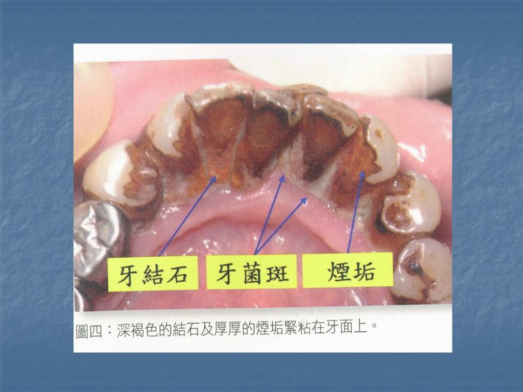 「認識職業，行行出狀元」—牙醫師